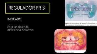 REGULADOR FR 3
INDICADO:
Para las clases III,
deficiencia del tercio
 