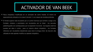 ACTIVADOR DE VAN BEEK
• Placa ortopédica modificada en un activador de cierre maxilar. El mismo es
especialmente utilizado en la clase II división 1 o en clases de mordida profunda.
• El frontal superior esta recubierto por un control resinoso que somete a carga a los
frontales .molares y premolares son recubiertos por la mitad , los escudos
palatolinguales son predispuestos por la expansión funcional ; los bigotes externos
puedes ser altos o cortos , para un máximo efecto ortopédico , los frontales
inferiores son recubiertos labialmente para tener la lengua libre .lla tracción alta
utilizada en este aparato modifica su aparato ortopédico.
 