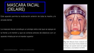 MASCARA FACIAL
(DELAIRE)
Este aparato permite la reubicación anterior de toda la maxila y la
arcada dental
La mascara facial constituye un anclaje extra oral que se apoya en
la frente y el mentón y que se conecta atreves de elásticos con un
aparato intrabucal en el maxilar superior
ATLAS DE ORTOPEDIA MAXILAR THOMAS RAKOSI IRMTRUD JONAS
 