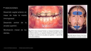 • INDICACIONES:
Desarrollo sagital anterior en
masa de toda la maxila
(micrognasia)
Desarrollo ventral de la
arcada superior}
Movilización mesial de los
dientes.
ATLAS DE ORTOPEDIA MAXILAR THOMAS RAKOSI IRMTRUD JONAS
 