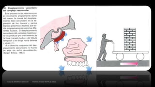 ATLAS DE ORTOPEDIA MAXILAR THOMAS RAKOSI IRMTRUD JONAS
 