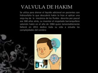 Se utiliza para drenar el liquido adicional en pacientes con
hidrocefalia lo que descubrió hakin lo hizo al aplicar una
vieja ley de la mecánica de los fluidos descrito por pascal
ase 300 años atrás, su inventor el respetado barranquillero
salomón hakin en el año de 1984 quien lamentablemente
falleció en 2011 dedico toda su vida a estudia las
complejidades del cerebro
VALVULA DE HAKIM
 