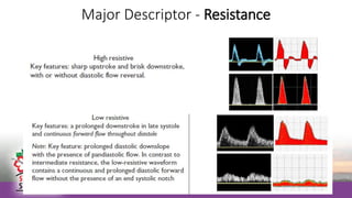 Major Descriptor - Resistance
 