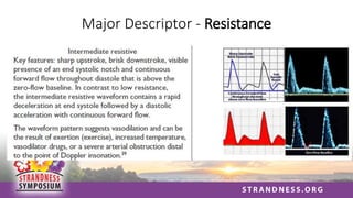 Major Descriptor - Resistance
 