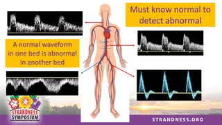 Must know normal to
detect abnormal
A normal waveform
in one bed is abnormal
in another bed
 