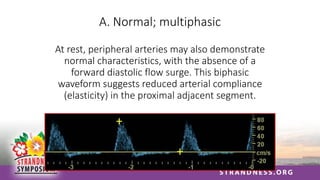 A. Normal; multiphasic
At rest, peripheral arteries may also demonstrate
normal characteristics, with the absence of a
forward diastolic flow surge. This biphasic
waveform suggests reduced arterial compliance
(elasticity) in the proximal adjacent segment.
 