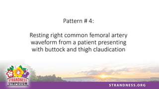 Pattern # 4:
Resting right common femoral artery
waveform from a patient presenting
with buttock and thigh claudication
 