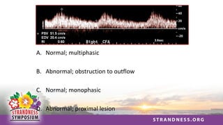 A. Normal; multiphasic
B. Abnormal; obstruction to outflow
C. Normal; monophasic
D. Abnormal; proximal lesion
 