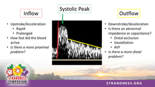 Inflow
• Upstroke/Acceleration
• Rapid
• Prolonged
• How fast did the blood
arrive
• Is there a more proximal
problem?
Outflow
• Downstroke/deceleration
• Is there an abnormal
impedence or capacitance?
• Distal occlusion
• Vasodilation
• AVF
• Is there a more distal
problem?
Systolic Peak
 