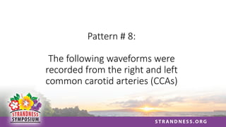 Pattern # 8:
The following waveforms were
recorded from the right and left
common carotid arteries (CCAs)
 