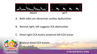 A. Both sides are abnormal; cardiac dysfunction
B. Normal right; left suggests ICA obstruction
C. Distal right CCA lesion; proximal left CCA lesion
D. Bilateral distal CCA lesions
RIGHT LEFT
 