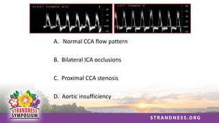 A. Normal CCA flow pattern
B. Bilateral ICA occlusions
C. Proximal CCA stenosis
D. Aortic insufficiency
 