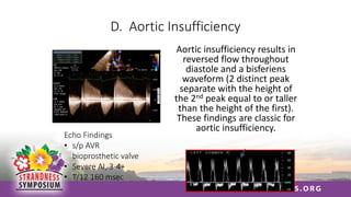 D. Aortic Insufficiency
Aortic insufficiency results in
reversed flow throughout
diastole and a bisferiens
waveform (2 distinct peak
separate with the height of
the 2nd peak equal to or taller
than the height of the first).
These findings are classic for
aortic insufficiency.
Echo Findings
• s/p AVR
bioprosthetic valve
• Severe AI, 3-4+
• T/12 160 msec
 