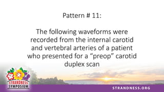 Pattern # 11:
The following waveforms were
recorded from the internal carotid
and vertebral arteries of a patient
who presented for a “preop” carotid
duplex scan
 