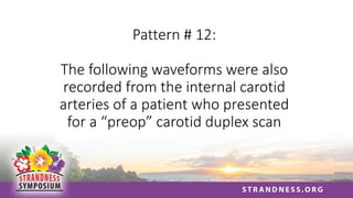 Pattern # 12:
The following waveforms were also
recorded from the internal carotid
arteries of a patient who presented
for a “preop” carotid duplex scan
 