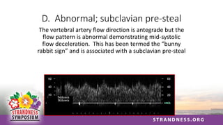 D. Abnormal; subclavian pre-steal
The vertebral artery flow direction is antegrade but the
flow pattern is abnormal demonstrating mid-systolic
flow deceleration. This has been termed the “bunny
rabbit sign” and is associated with a subclavian pre-steal
 