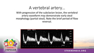 A vertebral artery…
With progression of the subclavian lesion, the vertebral
artery waveform may demonstrate early steal
morphology (partial steal). Note the brief period of flow
reversal.
 