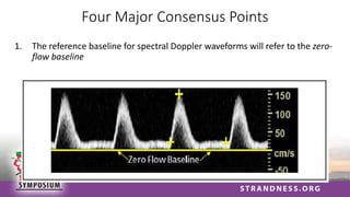 Four Major Consensus Points
1. The reference baseline for spectral Doppler waveforms will refer to the zero-
flow baseline
 