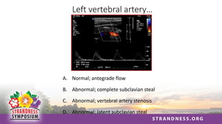 Left vertebral artery…
A. Normal; antegrade flow
B. Abnormal; complete subclavian steal
C. Abnormal; vertebral artery stenosis
D. Abnormal; latent subclavian steal
 