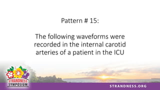 Pattern # 15:
The following waveforms were
recorded in the internal carotid
arteries of a patient in the ICU
 