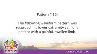 Pattern # 16:
The following waveform pattern was
recorded in a lower extremity vein of a
patient with a painful, swollen limb.
 