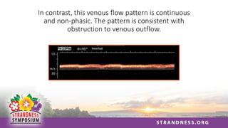 In contrast, this venous flow pattern is continuous
and non-phasic. The pattern is consistent with
obstruction to venous outflow.
 
