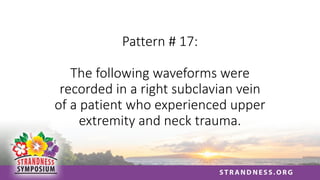 Pattern # 17:
The following waveforms were
recorded in a right subclavian vein
of a patient who experienced upper
extremity and neck trauma.
 
