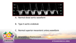 A. Normal distal aortic waveform
B. Type II aortic endoleak
C. Normal superior mesenteric artery waveform
D. Arterial pseudoaneurysm
 