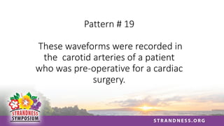 Pattern # 19
These waveforms were recorded in
the carotid arteries of a patient
who was pre-operative for a cardiac
surgery.
 