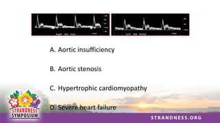 A. Aortic insufficiency
B. Aortic stenosis
C. Hypertrophic cardiomyopathy
D. Severe heart failure
 
