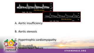 PSV 49 cm/sec
PSV 46 cm/sec
A. Aortic insufficiency
B. Aortic stenosis
C. Hypertrophic cardiomyopathy
D. Severe heart failure
 