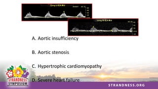A. Aortic insufficiency
B. Aortic stenosis
C. Hypertrophic cardiomyopathy
D. Severe heart failure
 