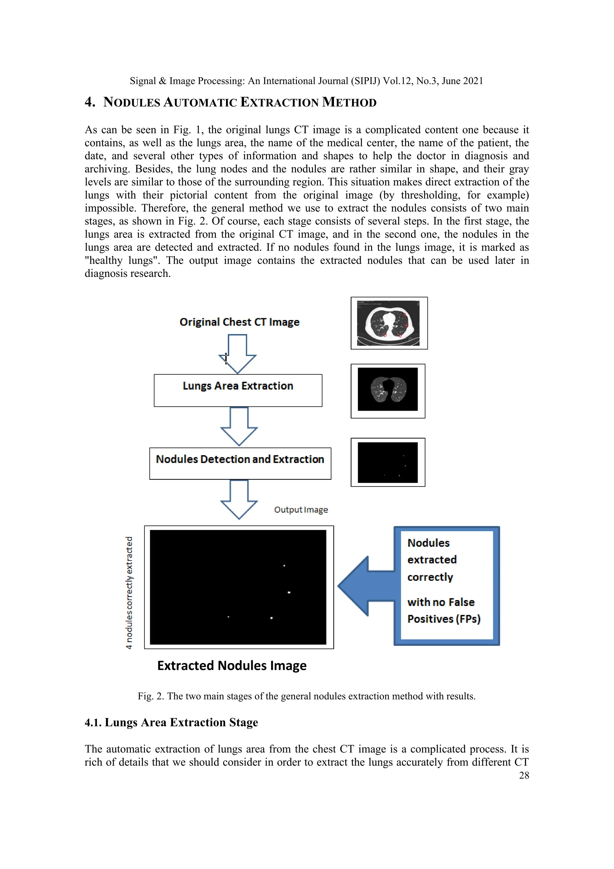 Signal & Image Processing: An International Journal (SIPIJ) Vol.12, No.3, June 2021
28
4. NODULES AUTOMATIC EXTRACTION METHOD
As can be seen in Fig. 1, the original lungs CT image is a complicated content one because it
contains, as well as the lungs area, the name of the medical center, the name of the patient, the
date, and several other types of information and shapes to help the doctor in diagnosis and
archiving. Besides, the lung nodes and the nodules are rather similar in shape, and their gray
levels are similar to those of the surrounding region. This situation makes direct extraction of the
lungs with their pictorial content from the original image (by thresholding, for example)
impossible. Therefore, the general method we use to extract the nodules consists of two main
stages, as shown in Fig. 2. Of course, each stage consists of several steps. In the first stage, the
lungs area is extracted from the original CT image, and in the second one, the nodules in the
lungs area are detected and extracted. If no nodules found in the lungs image, it is marked as
"healthy lungs". The output image contains the extracted nodules that can be used later in
diagnosis research.
Fig. 2. The two main stages of the general nodules extraction method with results.
4.1. Lungs Area Extraction Stage
The automatic extraction of lungs area from the chest CT image is a complicated process. It is
rich of details that we should consider in order to extract the lungs accurately from different CT
Extracted Nodules Image
 