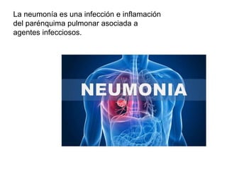 La neumonía es una infección e inflamación
del parénquima pulmonar asociada a
agentes infecciosos.
 
