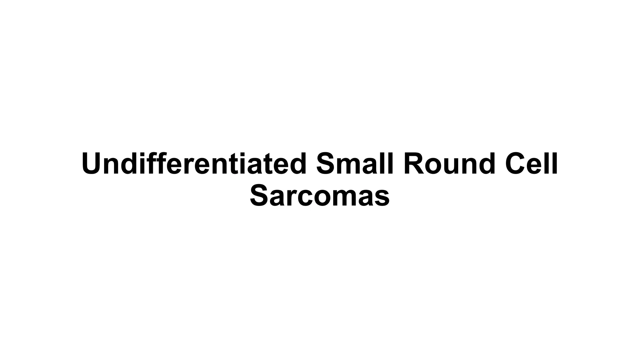 Undifferentiated Small Round Cell
Sarcomas
 