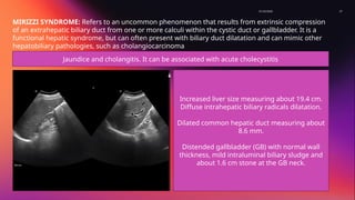 BILIARY TREE RADIOLOGY ADVANCE IMAGING (USG, CT SCAN, MRI AND ERCP) OF ...