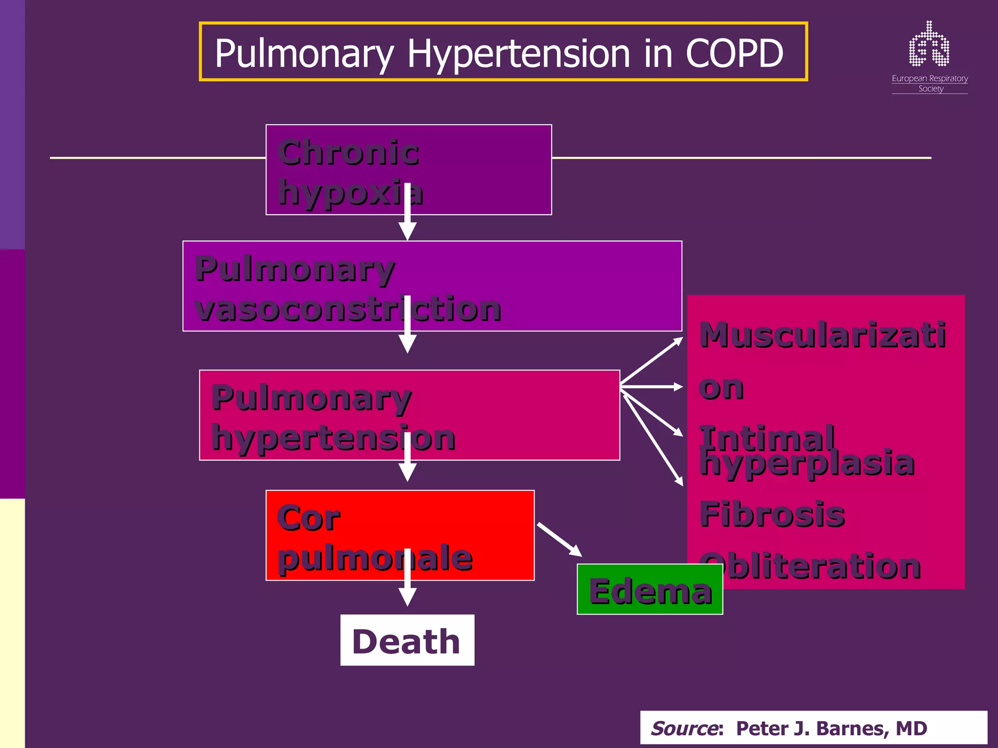 Chronic
Chronic
hypoxia
hypoxia
Pulmonary
Pulmonary
vasoconstriction
vasoconstriction
Muscularizati
Muscularizati
on
on
Intimal
Intimal
hyperplasia
hyperplasia
Fibrosis
Fibrosis
Obliteration
Obliteration
Pulmonary
Pulmonary
hypertension
hypertension
Cor
Cor
pulmonale
pulmonale
Death
Edema
Edema
Pulmonary Hypertension in COPD
Source: Peter J. Barnes, MD
 