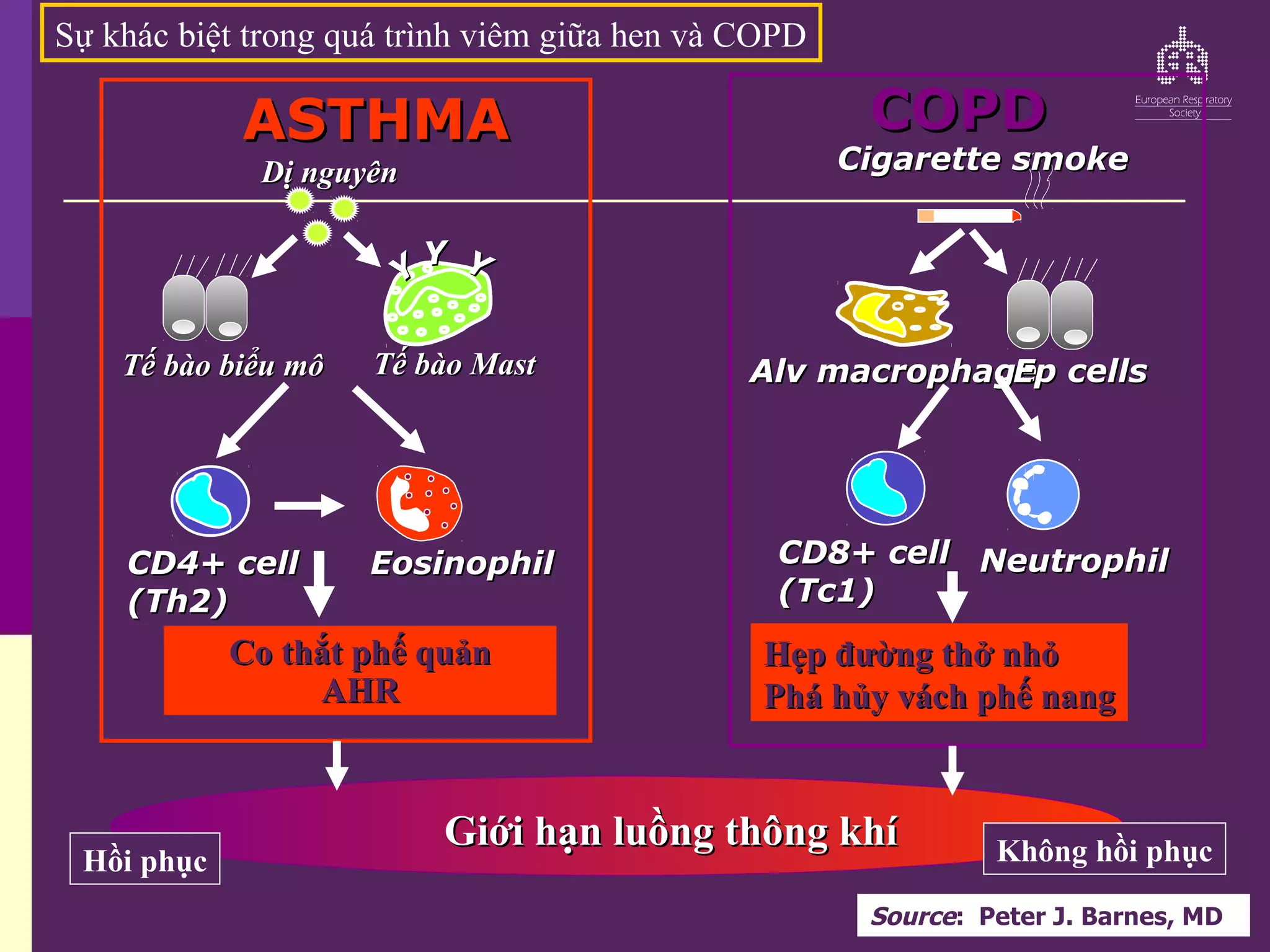 Sự khác biệt trong quá trình viêm giữa hen và COPD
Y
Y
Y
Y
Y
Y
Tế bào Mast
Tế bào Mast
CD4+ cell
CD4+ cell
(Th2)
(Th2)
Eosinophil
Eosinophil
Dị nguyên
Dị nguyên
Tế bào biểu mô
Tế bào biểu mô
ASTHMA
ASTHMA
Co thắt phế quản
Co thắt phế quản
AHR
AHR
Alv macrophage
Alv macrophage
Ep cells
Ep cells
CD8+ cell
CD8+ cell
(Tc1)
(Tc1)
Neutrophil
Neutrophil
Cigarette smoke
Cigarette smoke
Hẹp đường thở nhỏ
Hẹp đường thở nhỏ
Phá hủy vách phế nang
Phá hủy vách phế nang
COPD
COPD
Hồi phục Không hồi phục
Giới hạn luồng thông khí
Giới hạn luồng thông khí
Source: Peter J. Barnes, MD
 