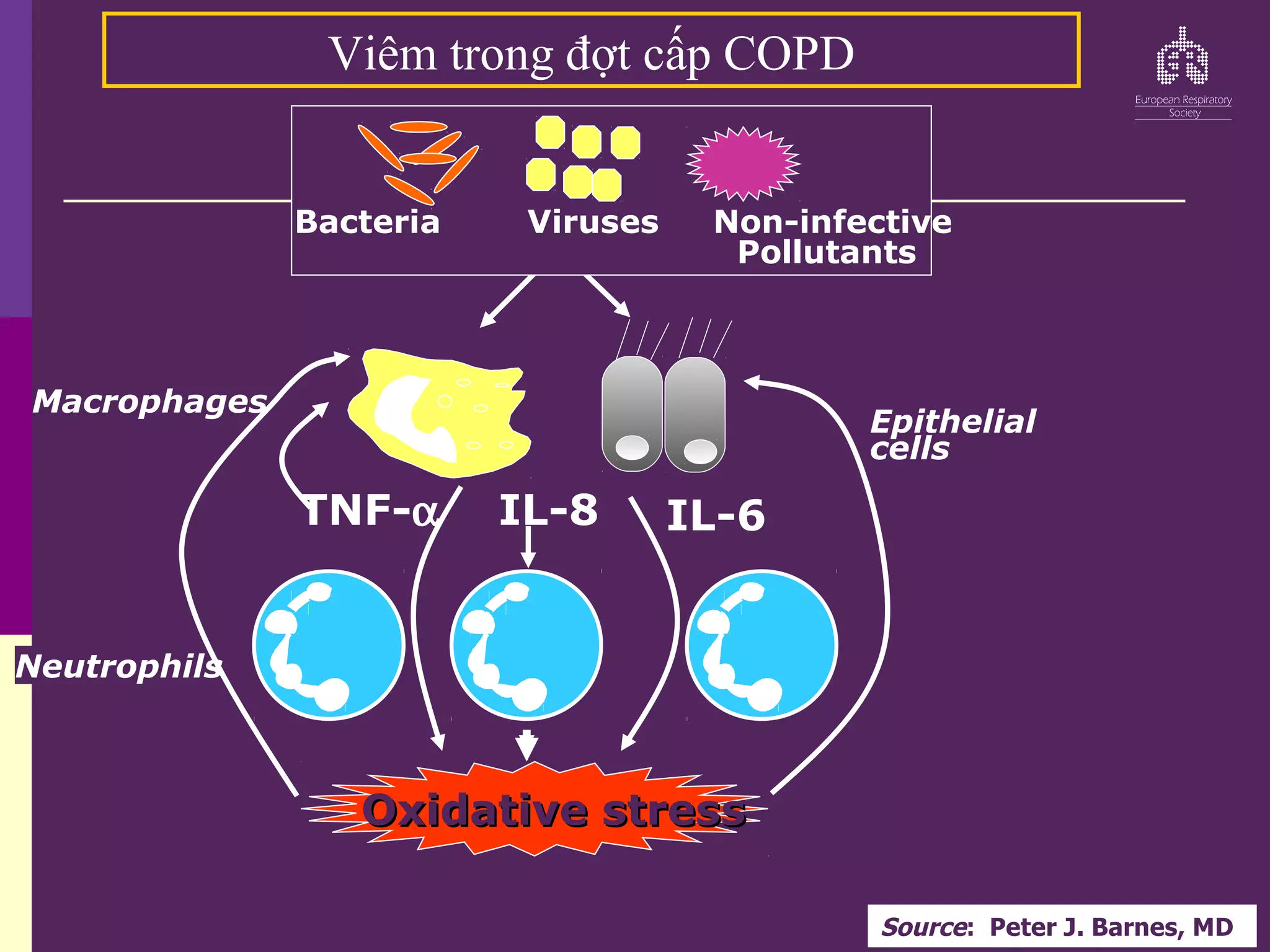 Macrophages
TNF-α IL-8 IL-6
Bacteria Viruses Non-infective
Pollutants
Epithelial
cells
Oxidative stress
Oxidative stress
Neutrophils
Viêm trong đợt cấp COPD
Source: Peter J. Barnes, MD
 