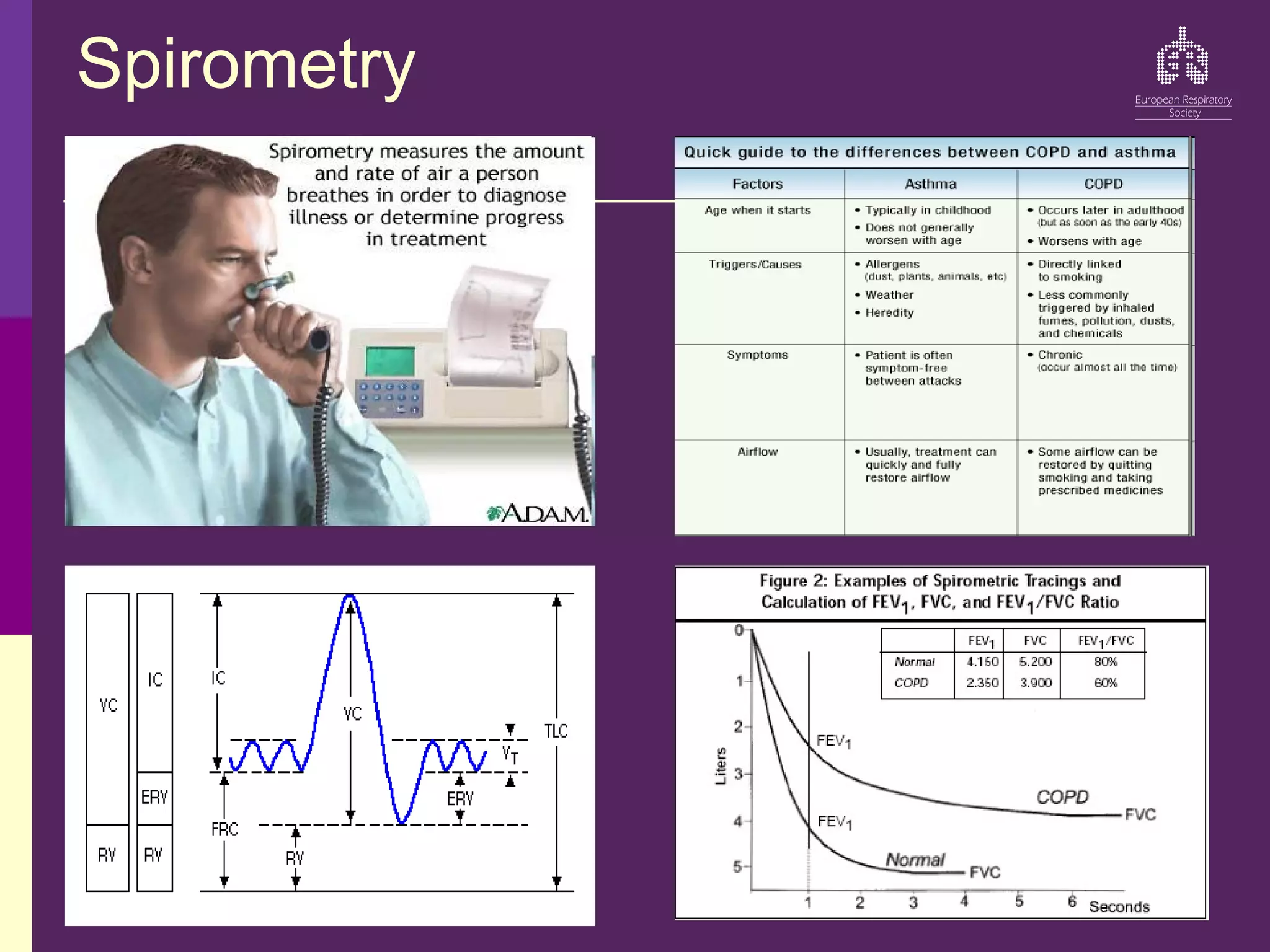 Spirometry
 