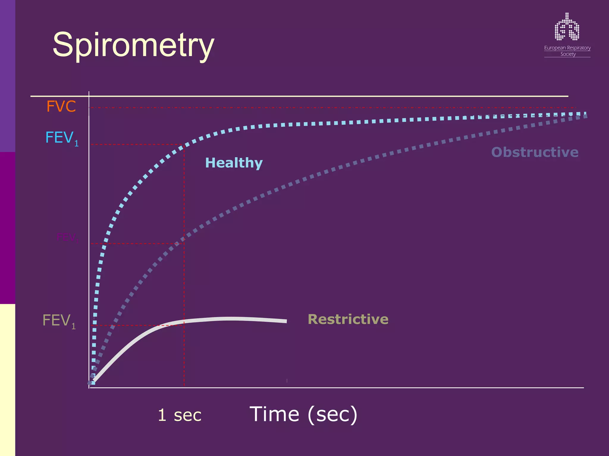 Spirometry
FVC
FEV1
FEV1
FEV1
Healthy
Obstructive
Restrictive
Time (sec)
1 sec
Volume
(litres)
 