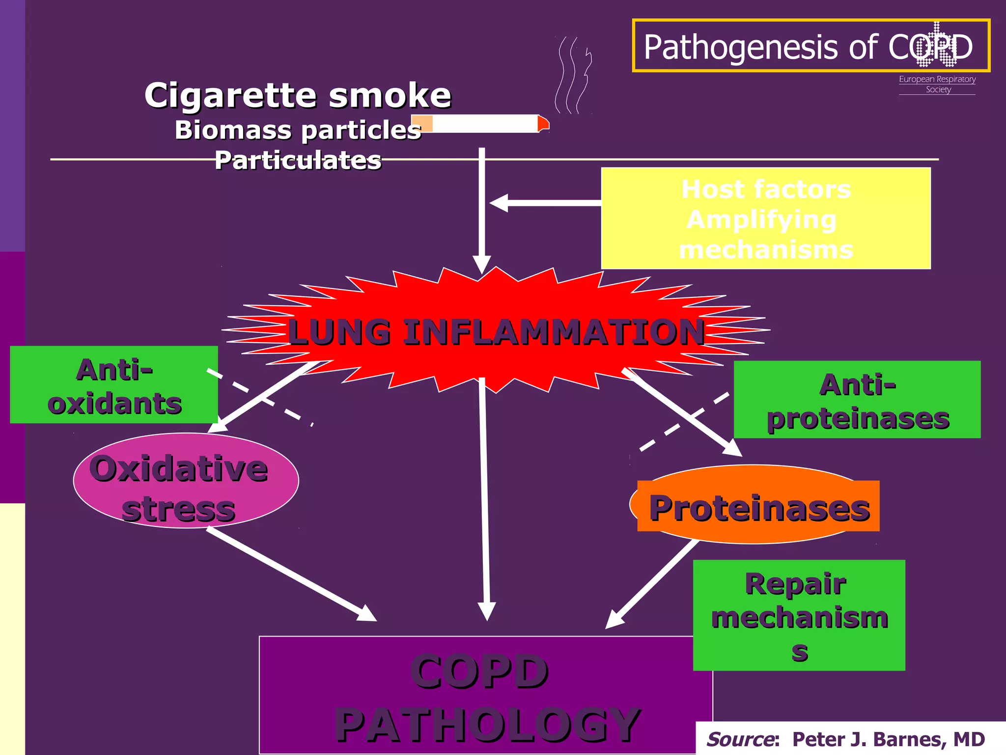 LUNG INFLAMMATION
LUNG INFLAMMATION
COPD
COPD
PATHOLOGY
PATHOLOGY
Oxidative
Oxidative
stress
stress Proteinases
Proteinases
Repair
Repair
mechanism
mechanism
s
s
Anti-
Anti-
proteinases
proteinases
Anti-
Anti-
oxidants
oxidants
Host factors
Amplifying
mechanisms
Cigarette smoke
Cigarette smoke
Biomass particles
Biomass particles
Particulates
Particulates
Pathogenesis of COPD
Source: Peter J. Barnes, MD
 