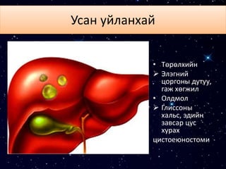 Усан уйланхай
• Төрөлхийн
 Элэгний
цоргоны дутуу,
гаж хөгжил
• Олдмол
 Глиссоны
хальс, эдийн
завсар цус
хурах
цистоеюностоми
 