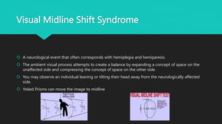 Visual Midline Shift Syndrome
 A neurological event that often corresponds with hemiplegia and hemiparesis.
 The ambient visual process attempts to create a balance by expanding a concept of space on the
unaffected side and compressing the concept of space on the other side.
 You may observe an individual leaning or tilting their head away from the neurologically affected
side.
 Yoked Prisms can move the image to midline
 
