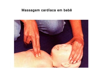 Massagem cardíaca em bebê

 