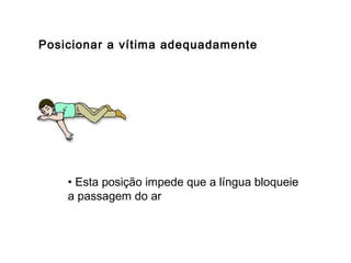Posicionar a vítima adequadamente

• Esta posição impede que a língua bloqueie
a passagem do ar

 