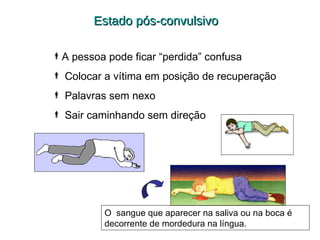 Estado pós-convulsivo
A pessoa pode ficar “perdida” confusa
 Colocar a vítima em posição de recuperação
 Palavras sem nexo
 Sair caminhando sem direção

O sangue que aparecer na saliva ou na boca é
decorrente de mordedura na língua.

 