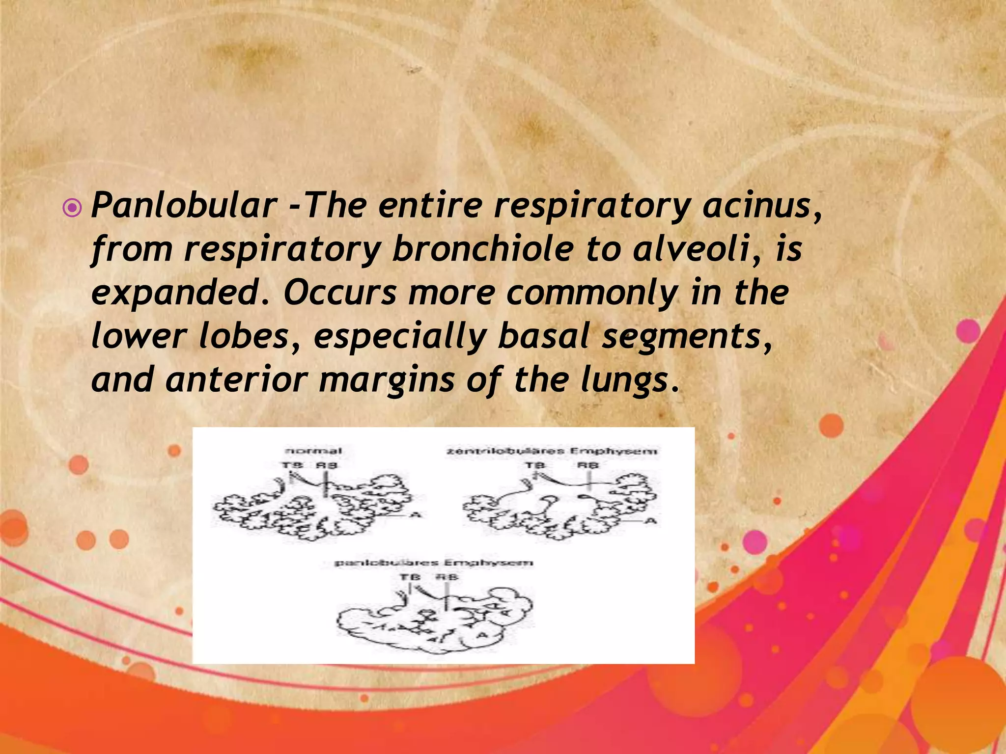  Panlobular-The entire respiratory acinus,
 from respiratory bronchiole to alveoli, is
 expanded. Occurs more commonly in the
 lower lobes, especially basal segments,
 and anterior margins of the lungs.
 