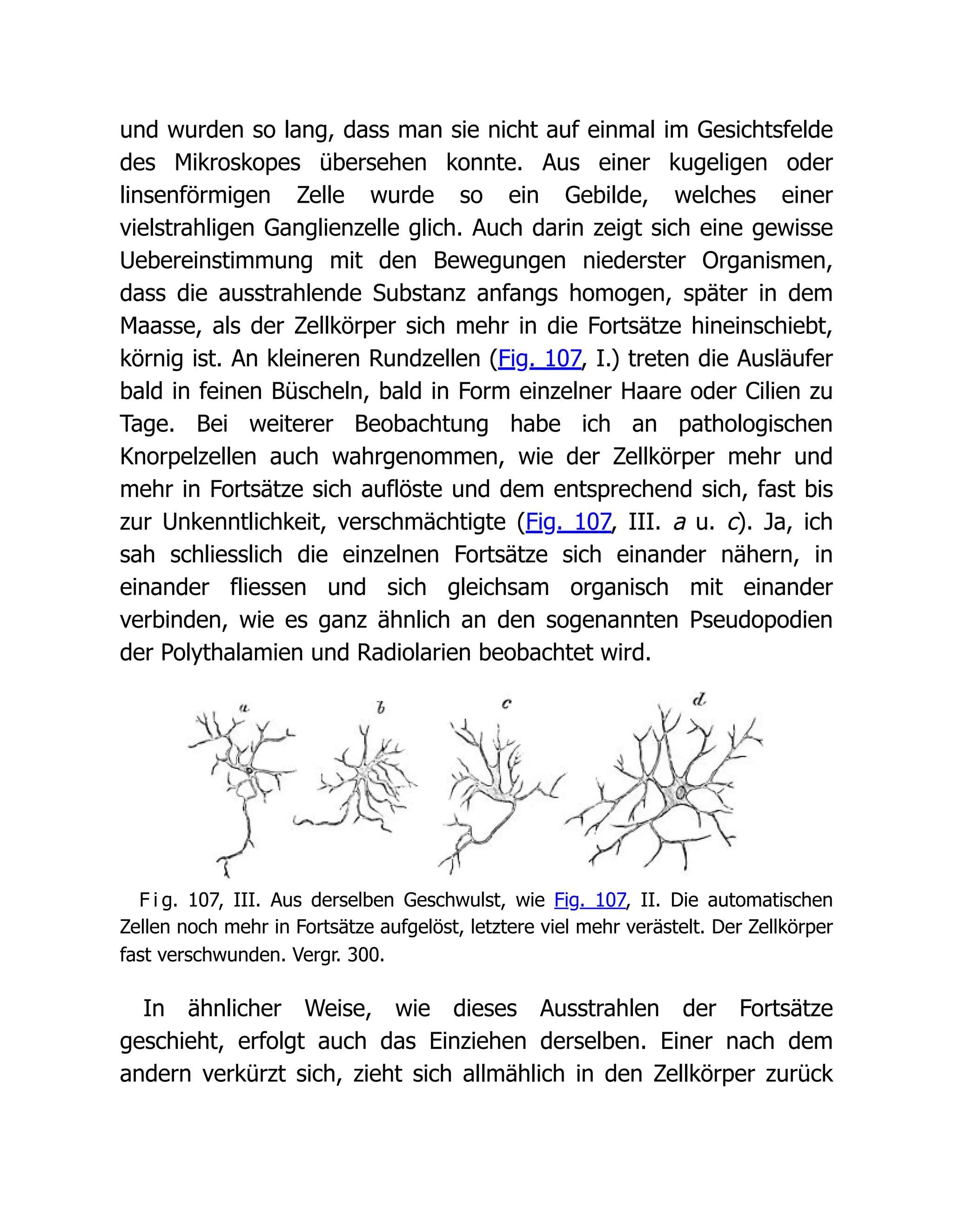 und wurden so lang, dass man sie nicht auf einmal im Gesichtsfelde
des Mikroskopes übersehen konnte. Aus einer kugeligen oder
linsenförmigen Zelle wurde so ein Gebilde, welches einer
vielstrahligen Ganglienzelle glich. Auch darin zeigt sich eine gewisse
Uebereinstimmung mit den Bewegungen niederster Organismen,
dass die ausstrahlende Substanz anfangs homogen, später in dem
Maasse, als der Zellkörper sich mehr in die Fortsätze hineinschiebt,
körnig ist. An kleineren Rundzellen (Fig. 107, I.) treten die Ausläufer
bald in feinen Büscheln, bald in Form einzelner Haare oder Cilien zu
Tage. Bei weiterer Beobachtung habe ich an pathologischen
Knorpelzellen auch wahrgenommen, wie der Zellkörper mehr und
mehr in Fortsätze sich auflöste und dem entsprechend sich, fast bis
zur Unkenntlichkeit, verschmächtigte (Fig. 107, III. a u. c). Ja, ich
sah schliesslich die einzelnen Fortsätze sich einander nähern, in
einander fliessen und sich gleichsam organisch mit einander
verbinden, wie es ganz ähnlich an den sogenannten Pseudopodien
der Polythalamien und Radiolarien beobachtet wird.
F i g. 107, III. Aus derselben Geschwulst, wie Fig. 107, II. Die automatischen
Zellen noch mehr in Fortsätze aufgelöst, letztere viel mehr verästelt. Der Zellkörper
fast verschwunden. Vergr. 300.
In ähnlicher Weise, wie dieses Ausstrahlen der Fortsätze
geschieht, erfolgt auch das Einziehen derselben. Einer nach dem
andern verkürzt sich, zieht sich allmählich in den Zellkörper zurück
 
