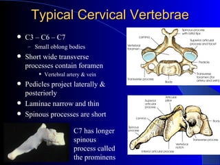 Typical Cervical Vertebrae <ul><li>C3 – C6 – C7 </li></ul><ul><ul><li>Small oblong bodies </li></ul></ul><ul><li>Short wid...